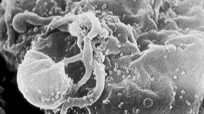 Elektronenmikroskopische Aufnahme einer von HIV infizierten Immunzelle, die viele Viruspartikel in die Umgebung abgibt (Bild: CDC | C. Goldsmith)