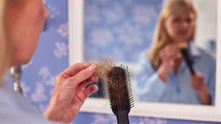 Frau mit Haarausfall