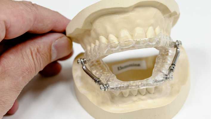 Ein Zahntechniker zeigt an einem Gebissmodell eine Schnarchschiene.